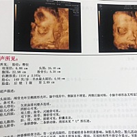 臀位，28周了，要不要采取点什么办法啊？想顺产啊，帮忙看看男宝女宝！马上要给宝宝准备衣服啦