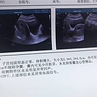 刚做完检查医生说发育不好，孩子不能要了，好难过啊，我想问问还有得有的救吗，会不会因为着床比较晚的原因