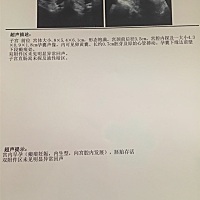 孕6周＋6天，今天去做B超，宝宝胎芽胎心都有了，可是，结果瘢痕妊娠，医生说我如果坚持怀孕的情况下会有...