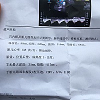 怀孕快八个月了 谁会看 帮我看看