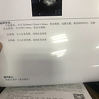 请准妈妈们帮我看看这个正不正常？我检查完医生下班了。怎么知道自己怀孕多久了？我是2月2号来的月经，...