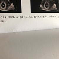 帮忙看看是男是女