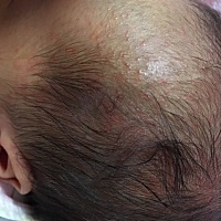 宝宝整个头上都长的这些东西，怎么办啊？