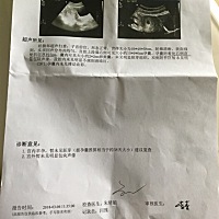 之前有点隐隐出血，吓死了,前天去照了B超说胎宝宝偏右，也有危险，怕一直靠右长就怕子宫破裂，吓死人了...