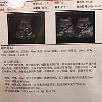 亲们有会看男女的朋友吗？