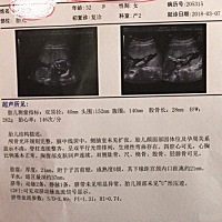 有没有有经验的可以看出男女