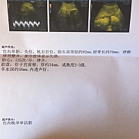 怎么看男女求大神解读🙏🙏🙏😂、也想知道多少斤了现在！好想快点卸货啊！🙆🙆🙆谢谢各位...