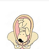 B超单上显示头位，这个是头位图吗？