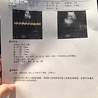 今天做的唐筛 B超结果显示宝宝大几天 有问题么？各位宝妈们帮忙看看