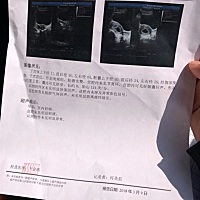 听说这个时间段就能看男女了，有会看的亲们吗？帮忙看下呢，就是好奇呢！