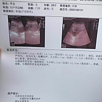 有会看的 58天的B超 帮忙看看男宝女宝