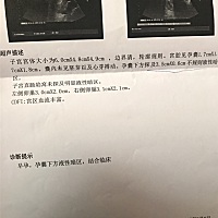 8 1了，昨天做的b超还没有胎心胎芽，医生说不太好，提心吊胆的等验血报告出来，心情复杂啊