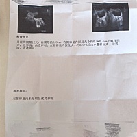 2月26日月经第一天，刚做卵泡监测是不是这月没希望了