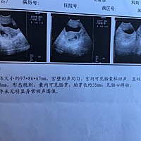 有大神可以看出男宝女宝吗