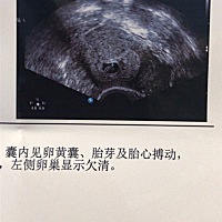 昨天拿孕酮才5.89吓死了今天一大早就来拍片了！胎心胎芽搏动都有了医生让赶紧打针吃药！希望宝宝健健康...