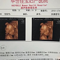 大神们 能看出男宝女宝嘛？