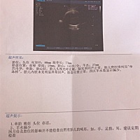 谁知道这个宝宝大概有多重？