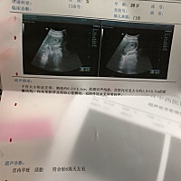 亲们 现在8周 3 但是我例假总是提前 具体每次都是用美釉来记录 ，上次末次例假1.11 但是我很不理解，例...