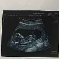 各位大神们，帮忙看下是男宝还是女宝呢？