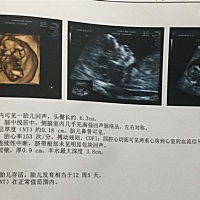 宝妈们，请帮忙告知男女，非常感谢🙏