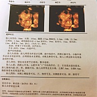 有会看男孩女孩的吗？帮我看下这是男孩还是女孩