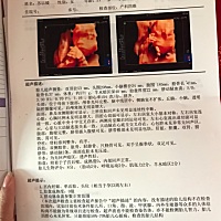 还有两个月这样就得生了。看看像男孩女孩😁