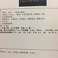 怎么办啊   羊水少了   医生建议住院  😢