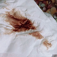 孕43天出现这情况，肚子不疼怎么回事啊？