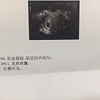 听说孕囊也能看男女，有经验的宝妈们帮忙看一下