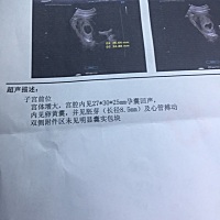 7周做的，有谁看的出来男女吗？第一胎比较好奇
