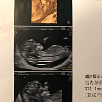 能看出男女吗？在想名字了😂