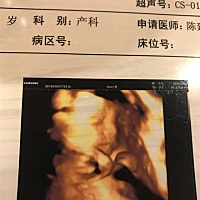 帮忙看一下有没有什么问题呢，医生说去复查，好害怕