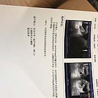 有看的懂是男宝还是女宝的吗？