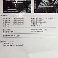 今天去检查了，一切都算正常，就是有点阴道炎症，医生开了点清洗的药，问题不大，这次二胎的B超结果，有...
