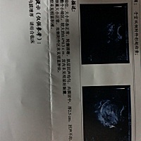1.15末次月经。月经周期不规律，3.6测出双杠，今天去抽血要明天出结果，b超还什么都看不见.....老公心情...