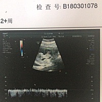 44天时孕囊1.9*1.6*0.8 8周时孕囊3.0*2.7*1.4 清宫表显示男 B超上中间偏右的字母是M 脸色很黄，皮肤糟糕...