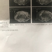 各位大神帮忙看看男女宝啊