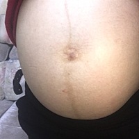 我想问一下孕妈们，做B超一个亲戚认识一个老阿姨亲自看的说是男宝宝。做四维也是有认识的人看的说是男宝...