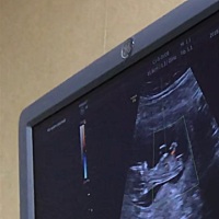 还有人没睡吗？帮忙看看男宝女宝呀