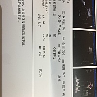 孕37周➕5天，谁能看出是男是女