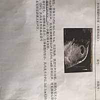 怀孕6周，去医院打B超和验血，结果孕酮偏低。子宫里面可能还有流血状况怎么办？我第一次怀孕28岁！