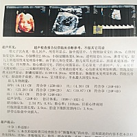 大家帮忙看看是女宝，还是男宝？