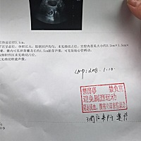 热乎乎的胎心胎芽！昨天给我留言的宝妈们，加油哦，八周4天检查出来了！