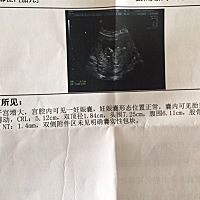 Nt 顺利通过。接好孕。谁能帮忙看一下男女。