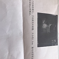 怀孕四十天了，没见明显胎芽和原始心管搏动正常么？？