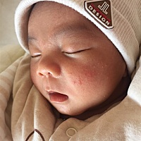 宝宝出生十几天脸上长了这些一粒粒的东西，像小痘痘一样有白点点，哪位宝妈知道是什么呀？