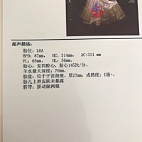 今天心情超级好，上午去医院做B超，医生说宝宝各方面发育的都很好。胎位很好，羊水很清，也没脐带绕颈。...