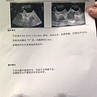 大家有没有孕前检查、超声提示：考虑不完全纵隔子宫