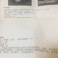 35周做的超声波 为什么上面没有这多少周  而且又不详细 会是个女宝宝吗