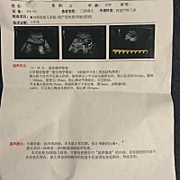 今天上午突然见红跑去医院看了，还好宝宝一切正常，可以看得出男宝还是女宝吗